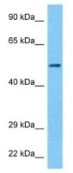 Nicotinic Acetylcholine Receptor beta Rabbit anti-Human, Polyclonal, Novus
